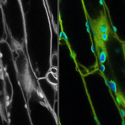 学习如何从共聚焦图像中去除自发荧光