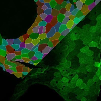 直播预告 | 从传统生物医学图像处理到AI图像分析——懒人的进阶之路