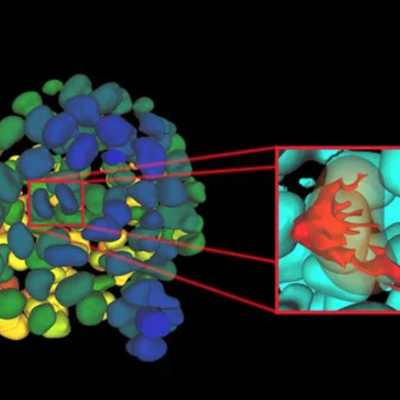 直播回顾|复杂样品智能识别及自定义处理工作流