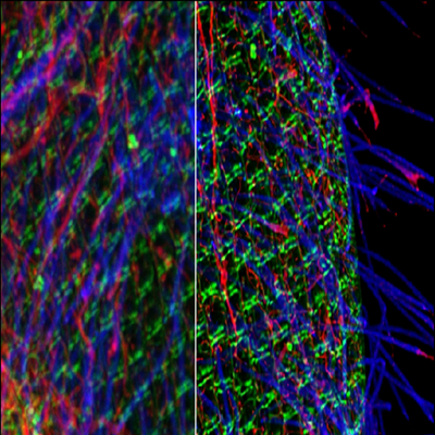 直播预告 | 穿越光的时空门：共聚焦的神奇应用探索