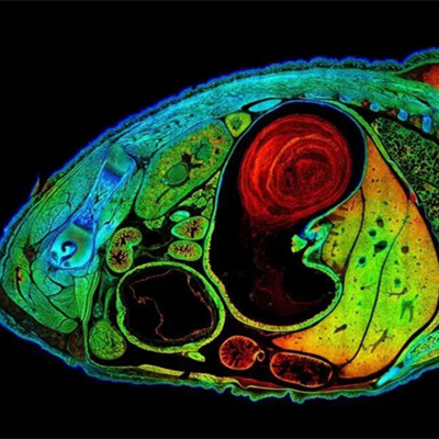 直播预告 | FALCON-快速荧光寿命成像应用进展