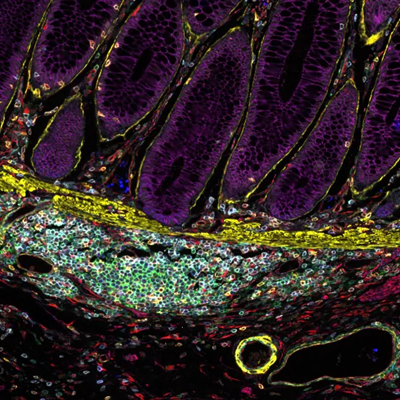 国家以旧换新政策 | 徕卡生命科学部积极响应