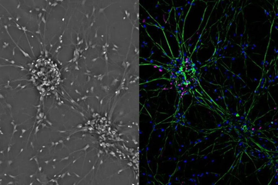 哺乳动物细胞培养全指南：从形态学分类到数字化成像技术 (Leica Mateo TL 篇)