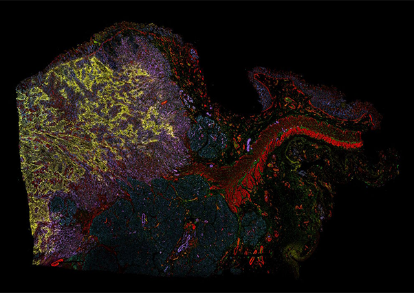 药物发现中的靶点生物学和细胞生物学研究