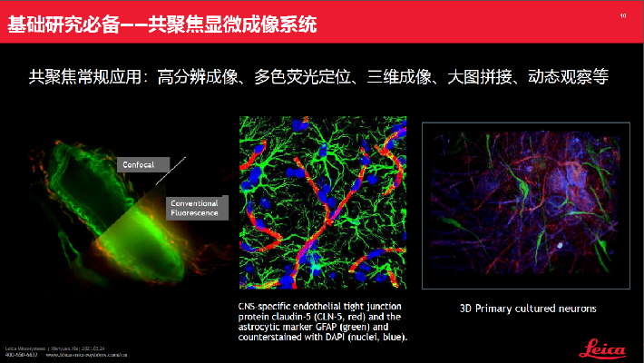 直播回顾︱跨尺度神经生物学显微成像解决方案