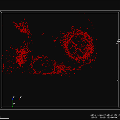 直播预告：掌握Aivia 机器学习，轻松精准分析各类图像