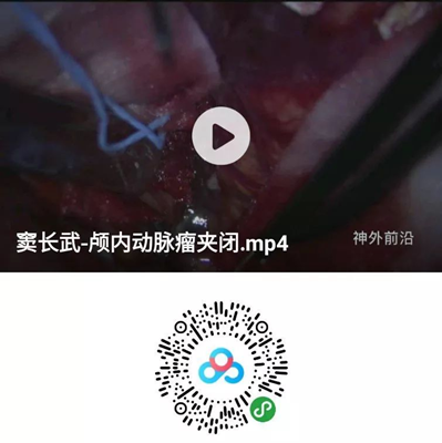 徕卡神刀博览第33期|专访内蒙医大附院窦长武: 年神外手术量超过1100台 重点发展脑血管病和脑肿瘤专业(附手术视频）